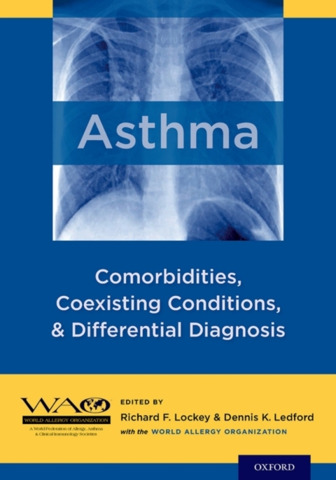 Cover image for book Asthma