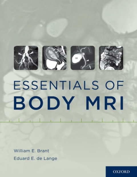 Cover image for book Essentials of Body MRI