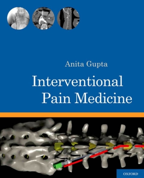 Cover image for book Interventional Pain Medicine