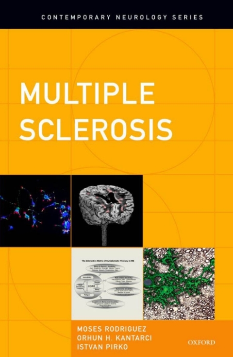 Cover image for book Multiple Sclerosis