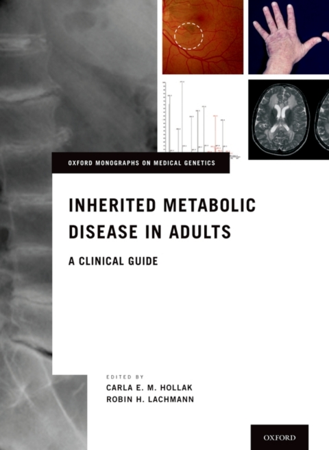 Cover image for book Inherited Metabolic Disease in Adults
