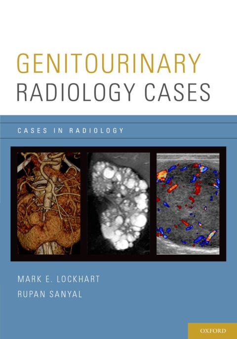 Cover image for book Genitourinary Radiology Cases