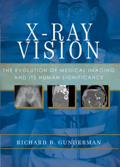 Cover image for book X-Ray Vision