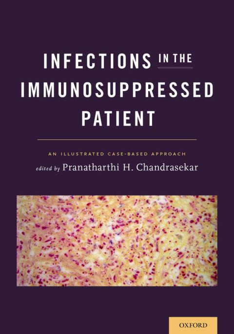 Cover image for book Infections in the Immunosuppressed Patient