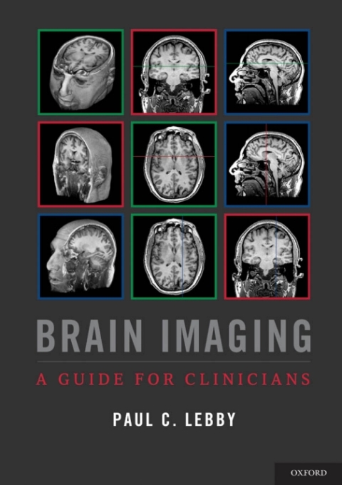Cover image for book Brain Imaging