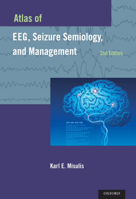 Cover image for book Atlas of EEG, Seizure Semiology, and Management