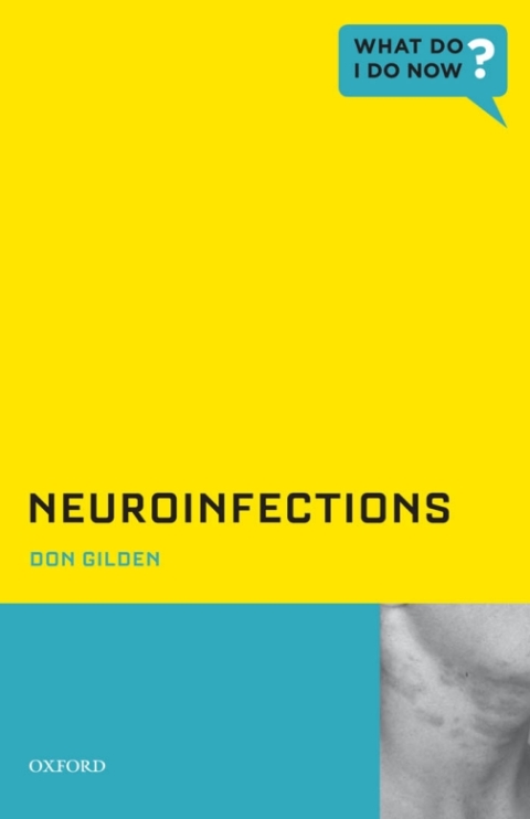 Cover image for book Neuroinfections