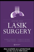 Step by Step LASIK Surgery - Namrata Sharma