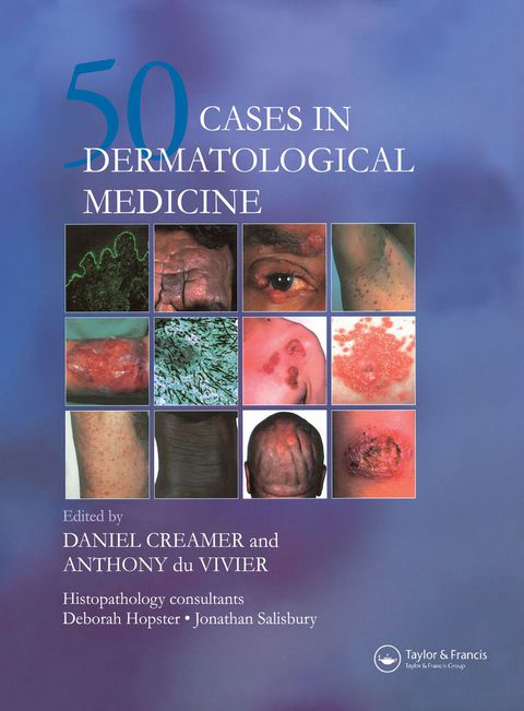Cover image for book Fifty Dermatological Cases
