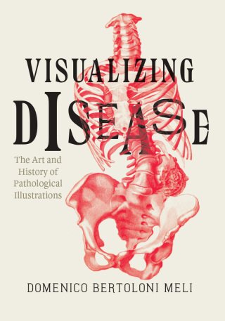 Visualizing Disease