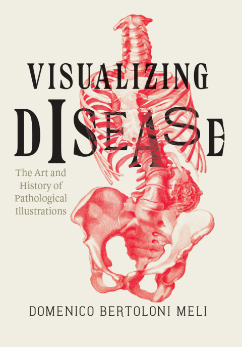 Visualizing Disease 
