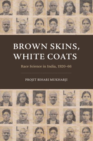Brown Skins, White Coats