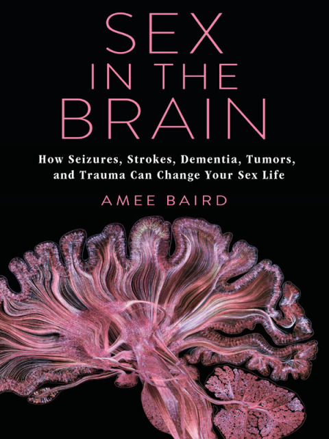 Cover image for book Sex in the Brain