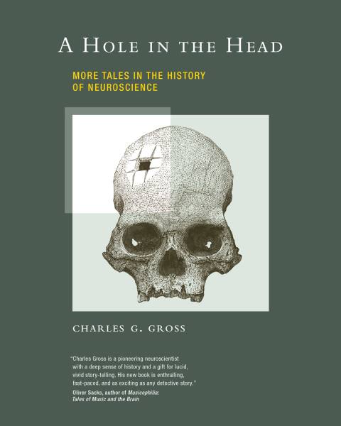 Cover image for book A Hole in the Head