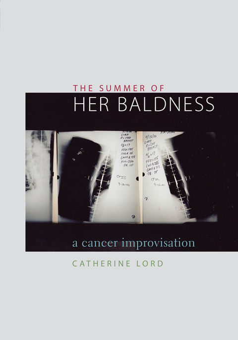 Cover image for book The Summer of Her Baldness