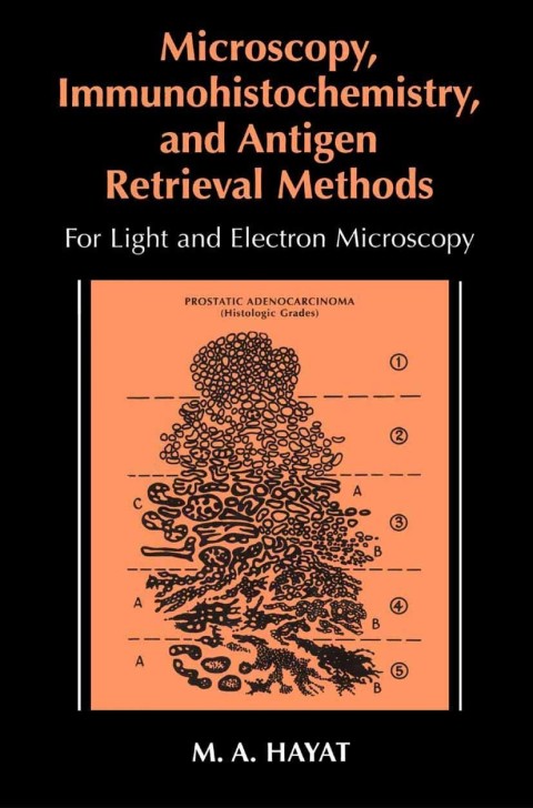 Cover image for book Microscopy, Immunohistochemistry, and Antigen Retrieval Methods