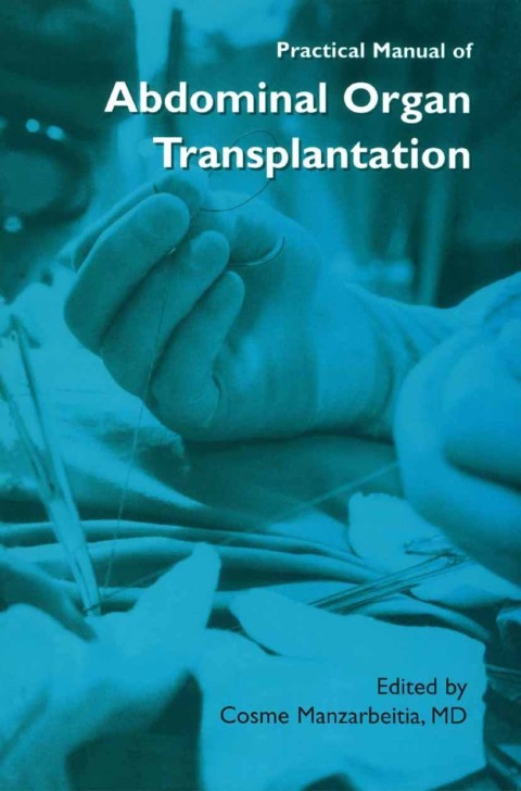 Cover image for book Practical Manual of Abdominal Organ Transplantation