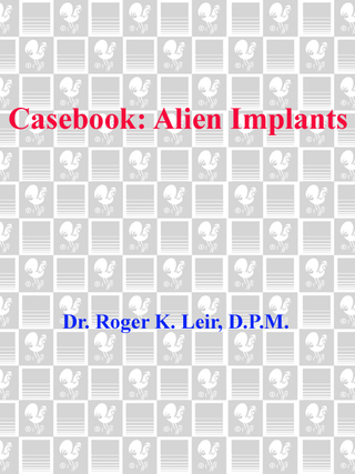 Casebook: Alien Implants