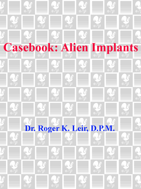 Cover image for book Casebook: Alien Implants