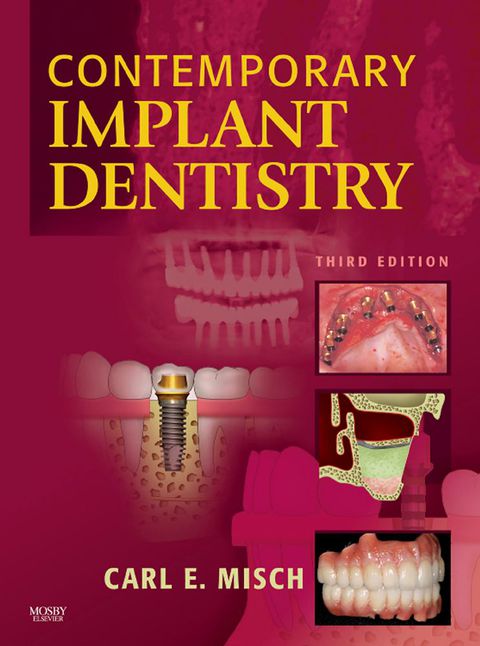 Cover image for book Contemporary Implant Dentistry