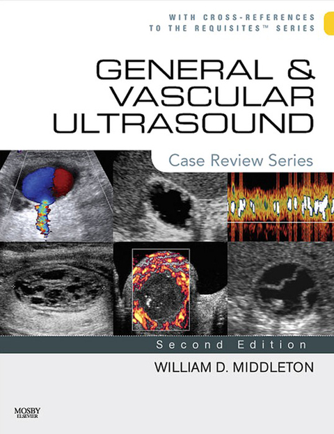 Cover image for book General and Vascular Ultrasound: Case Review Series