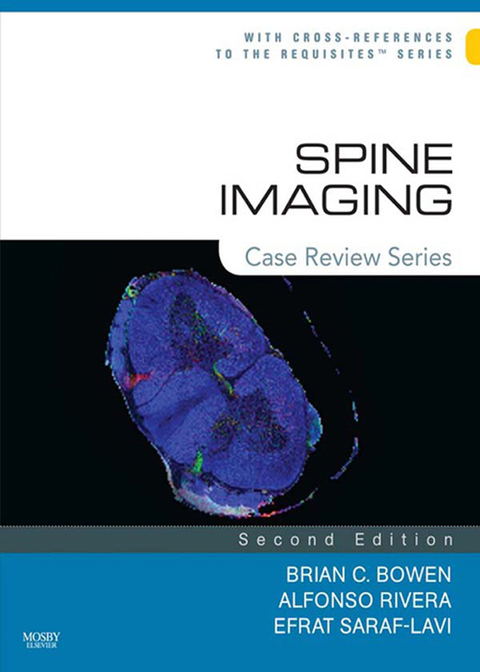 Spine Imaging: Case Review Series 