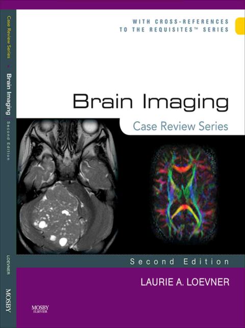 Brain Imaging: Case Review Series 
