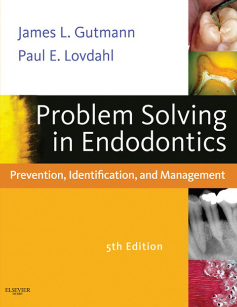 Cover image for book Problem Solving in Endodontics