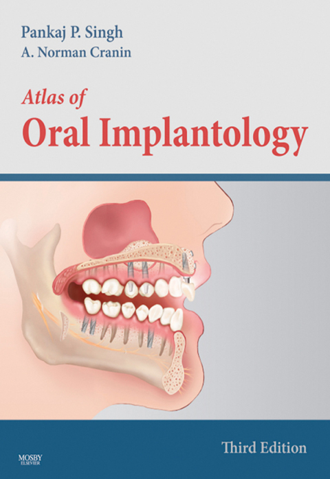 Atlas of Oral Implantology 