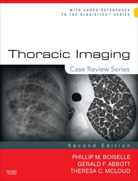 Cover image for book Thoracic Imaging: Case Review Series
