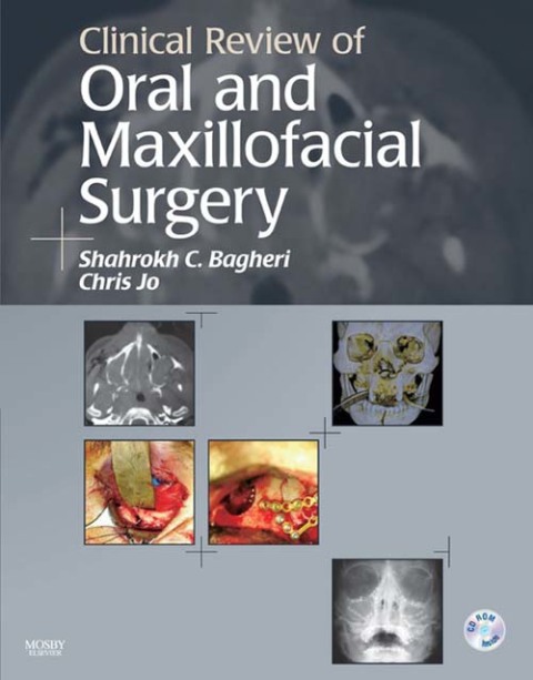 Cover image for book Clinical Review of Oral and Maxillofacial Surgery