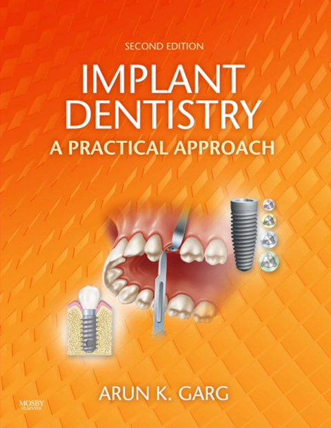 Cover image for book Implant Dentistry