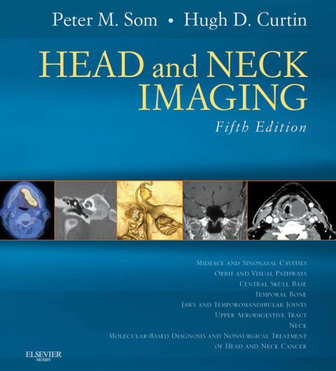 Cover image for book Head and Neck Imaging