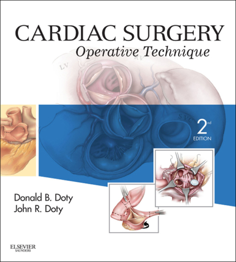 Cover image for book Cardiac Surgery: Operative and Evolving Technique