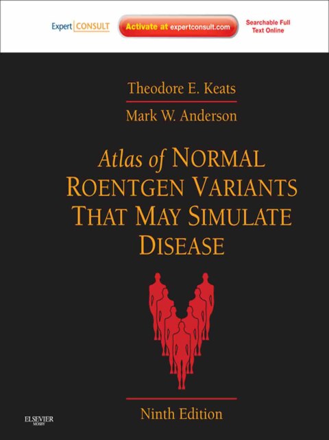 Atlas of Normal Roentgen Variants That May Simulate Disease 
