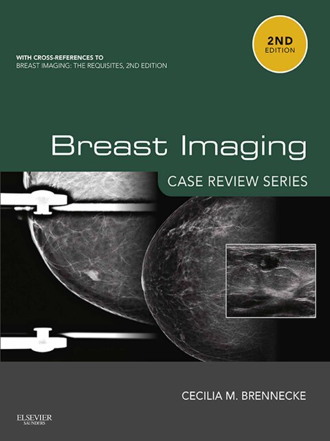 Cover image for book Breast Imaging: Case Review Series