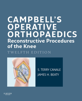 Campbell's Operative Orthopaedics: Reconstructive Procedures of the Knee