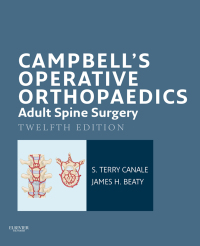 Campbell's Operative Orthopaedics: Adult Spine Surgery 12th edition ...