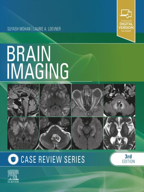 Cover image for book Brain Imaging: Case Review Series