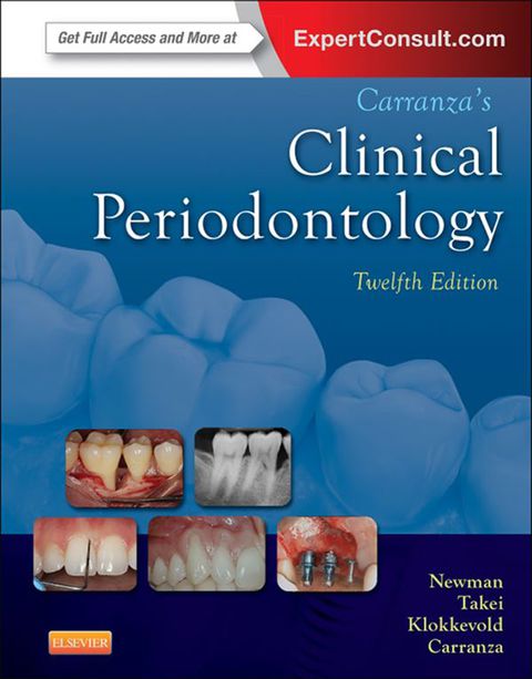 Cover image for book Carranza's Clinical Periodontology