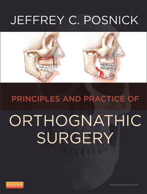 Cover image for book Orthognathic Surgery