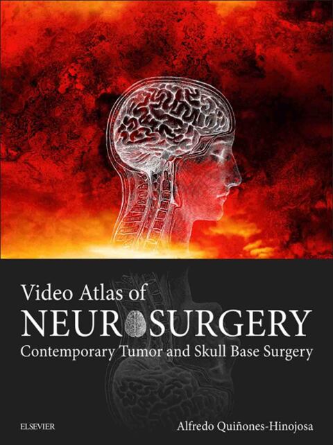 Cover image for book Video Atlas of Neurosurgery
