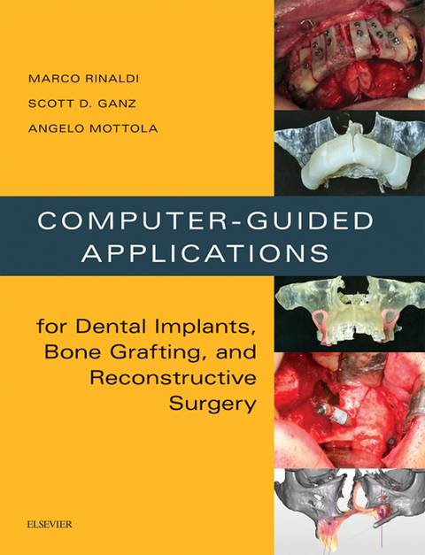 Cover image for book Computer-Guided Applications for Dental Implants, Bone Grafting, and Reconstructive Surgery (Adapted Translation)
