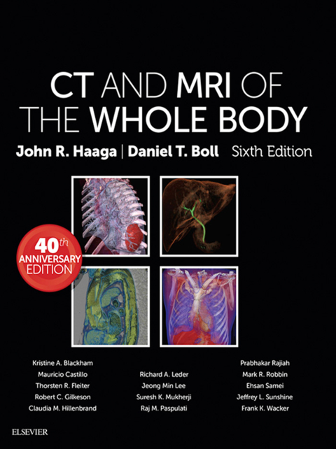 Cover image for book Computed Tomography & Magnetic Resonance Imaging Of The Whole Body E-Book