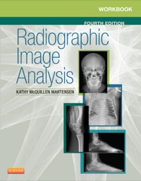 Cover image: Workbook for Radiographic Image Analysis 4th edition 9780323280716