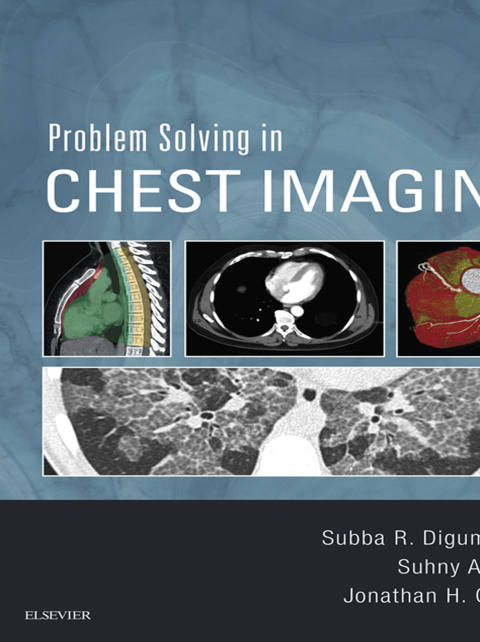 Problem Solving in Chest Imaging 