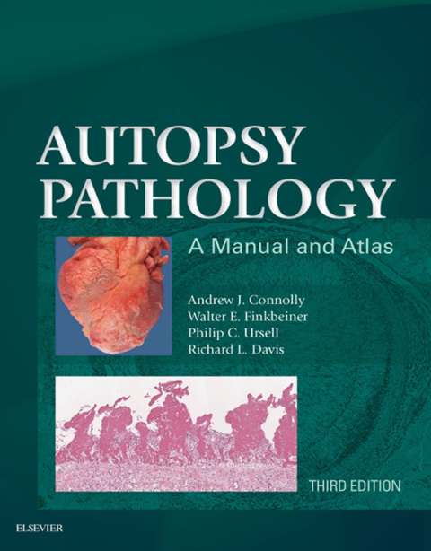 Autopsy Pathology: A Manual and Atlas 