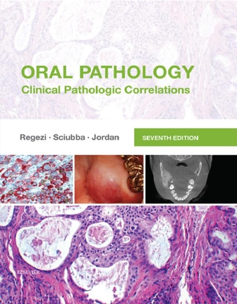 Cover image for book Oral Pathology: Clinical Pathologic Correlations