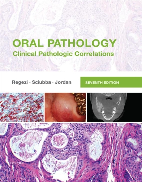 Oral Pathology: Clinical Pathologic Correlations 