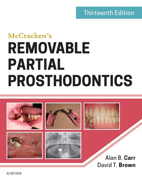 Cover image for book McCracken's Removable Partial Prosthodontics